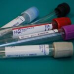 Dr Lal PathLabs feels margin heat as it chases growth, long-term outlook remains strong