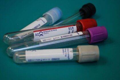 Dr Lal PathLabs feels margin heat as it chases growth, long-term outlook remains strong